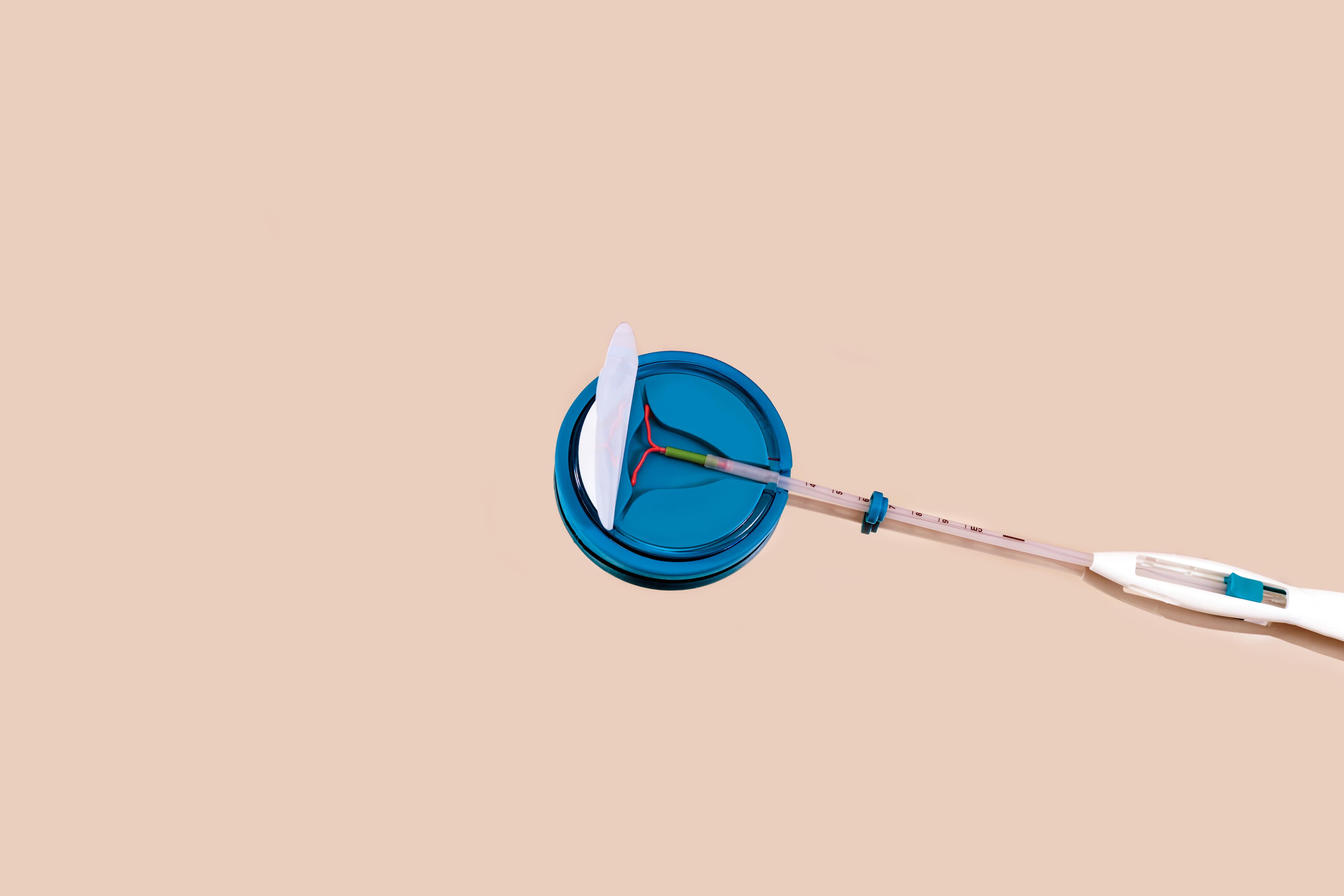 Hormonal IUD graphic Hormonal IUD graphic
